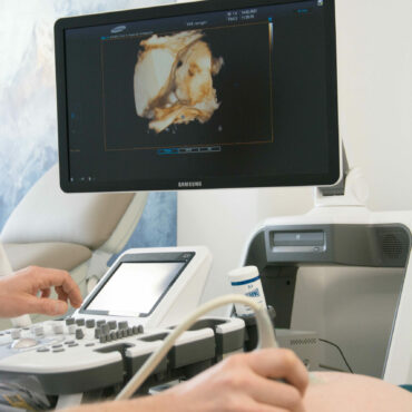 3D/4D ultrazvukové vyšetření