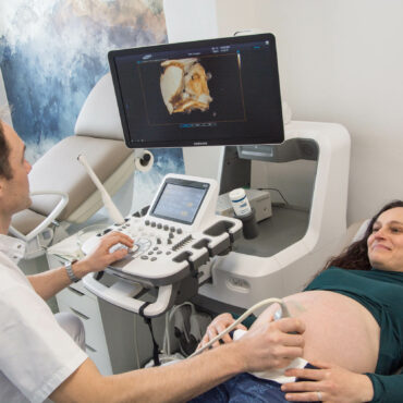 3D/4D ultrazvukové vyšetření